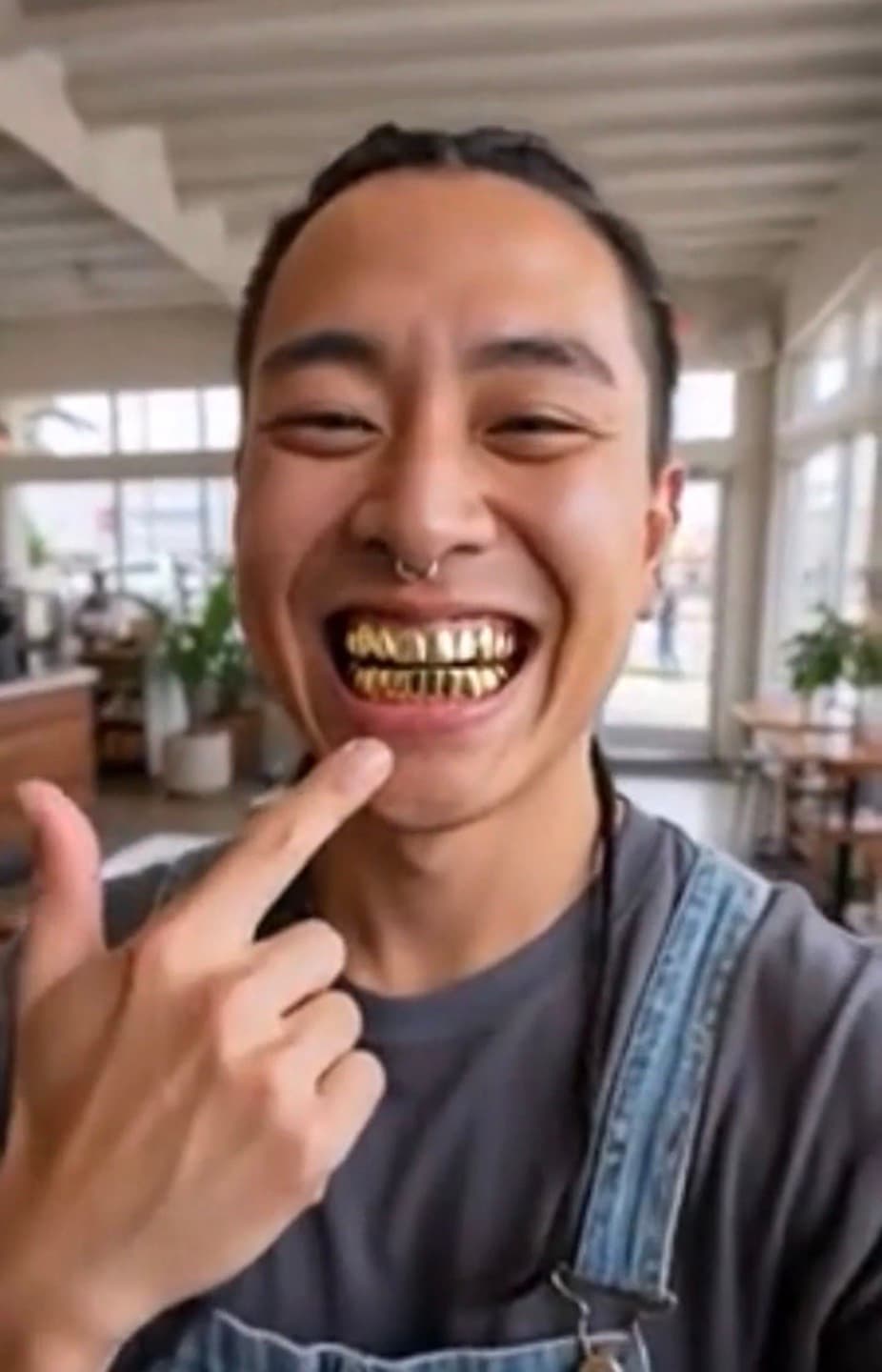 gold teeth